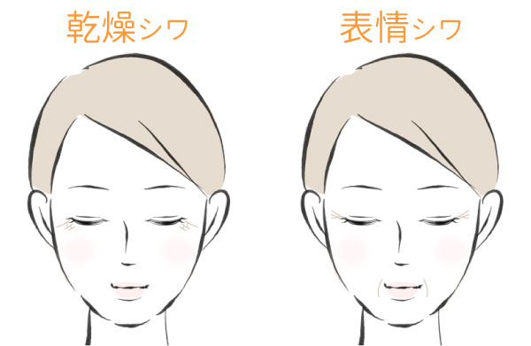 シワの種類のイラスト（乾燥シワと表情シワ）